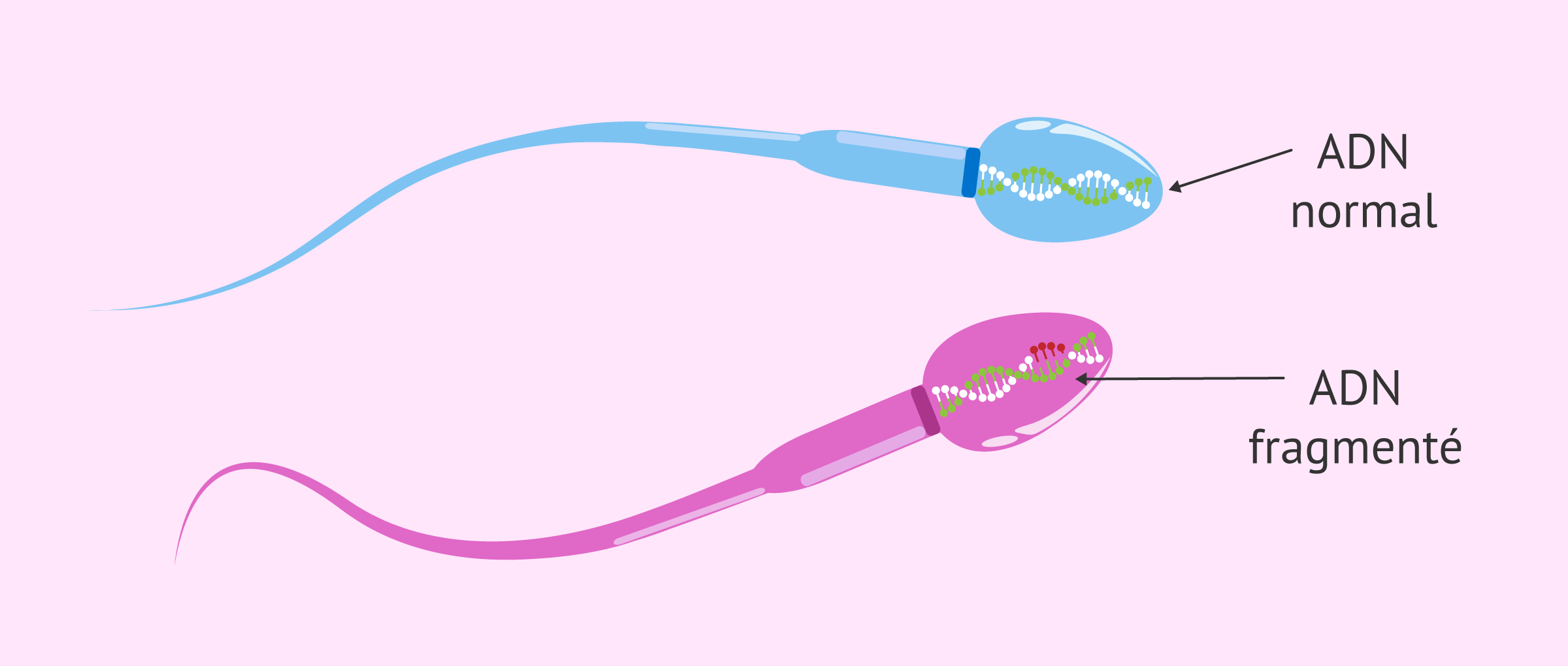 spermatozoides-normaux-et-fragmentes image spermatozoides-normaux-et-fragmentes Infertilité